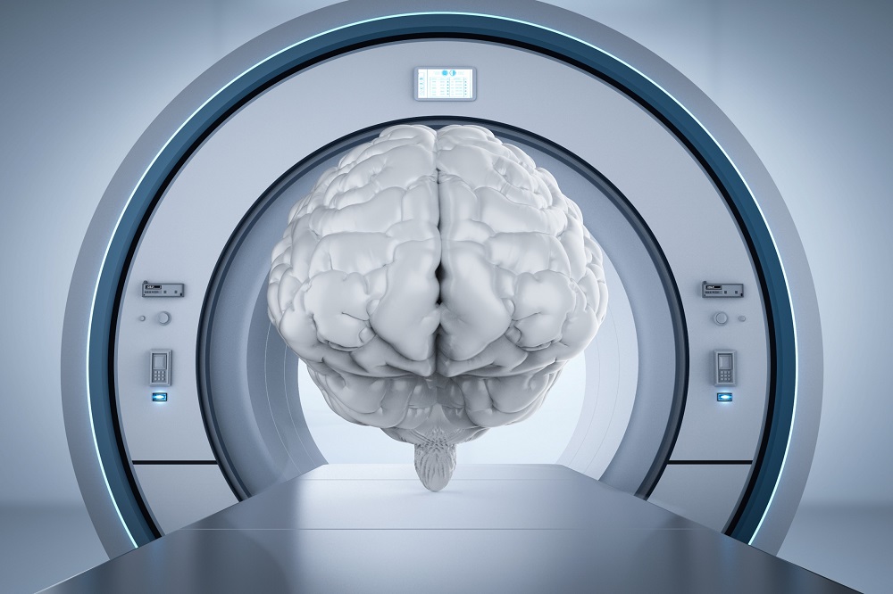 Imagen: El algoritmo de IA predice la probabilidad de progresión de DCLA a la demencia de Alzheimer en cinco años (Fotografía cortesía de 123RF)